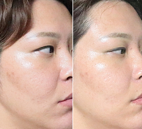 임산부 피부열감 잡아주는데 효과좋아요