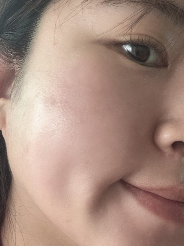 수분감이 바로 느껴지는 앰플