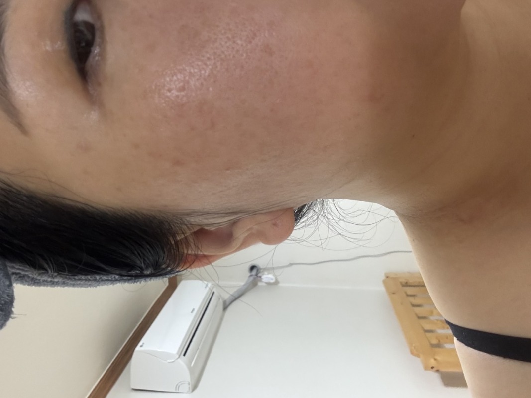 좁쌀 많이 좋아짐