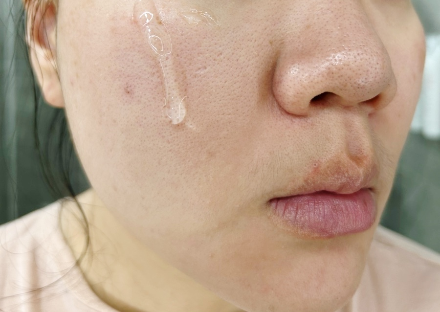 여드름성 피부 진정효과에 좋은 비비드 그린 카밍 앰플