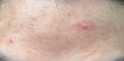 4주 째 쓰고 있는 후기 (피부 사진 첨가)